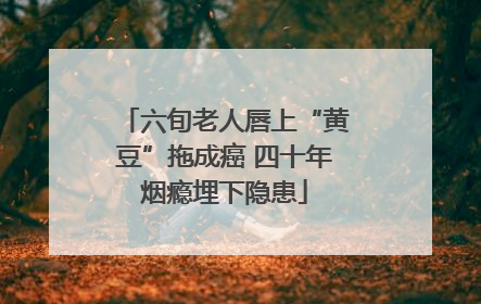 六旬老人唇上“黄豆”拖成癌 四十年烟瘾埋下隐患